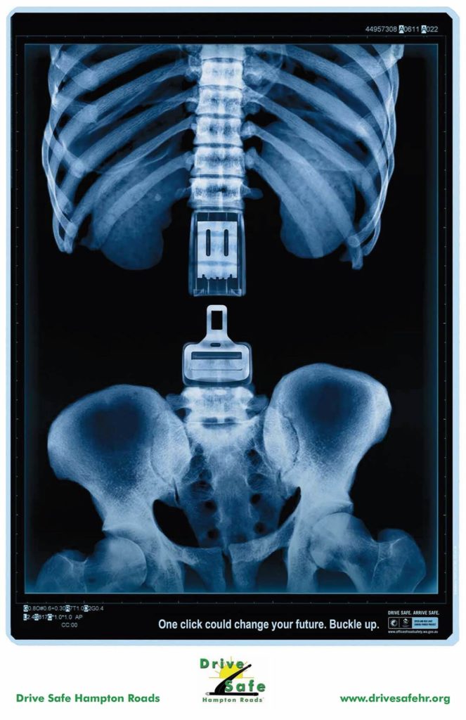 X Ray Poster Buckle up One Click SPINE 1210x1870 1